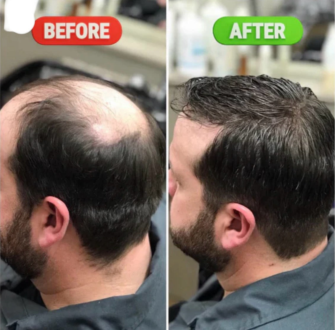 Rosemary & Rice Water Hair Growth Spray